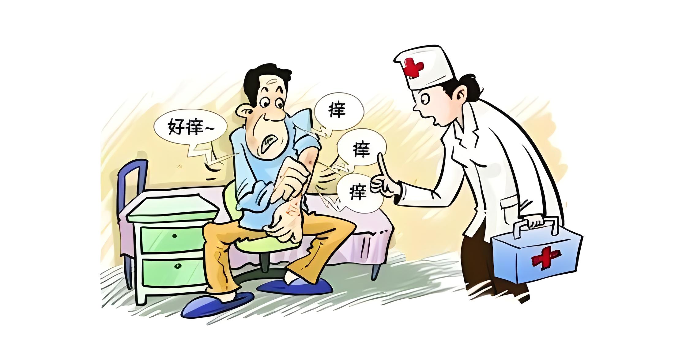 银屑病治疗
