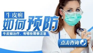 如何效防止牛皮癣复发